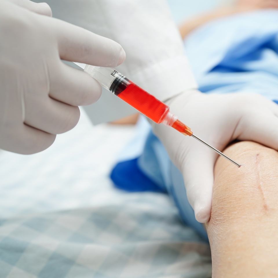 Asian doctor inject Hyaluronic acid platelet rich plasma into the knee of senior woman to walk without pain.