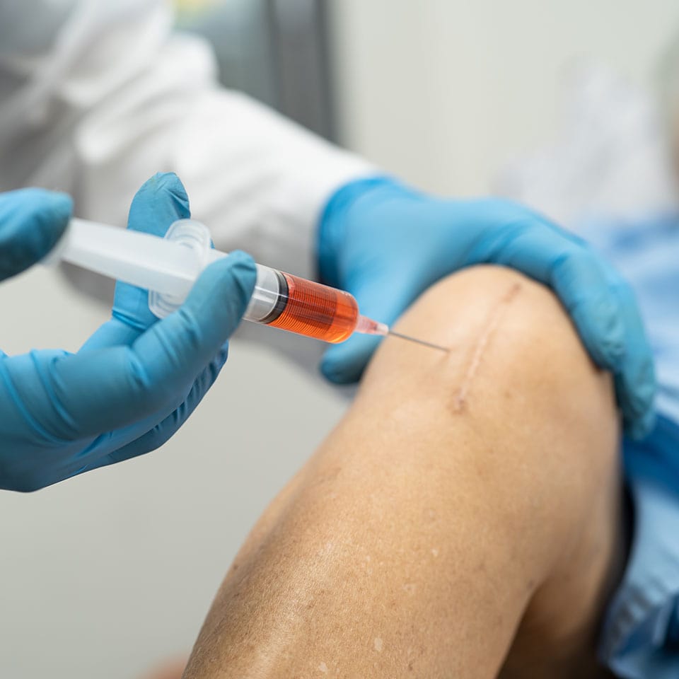 Asian doctor inject Hyaluronic acid platelet rich plasma into the knee of senior woman to walk without pain